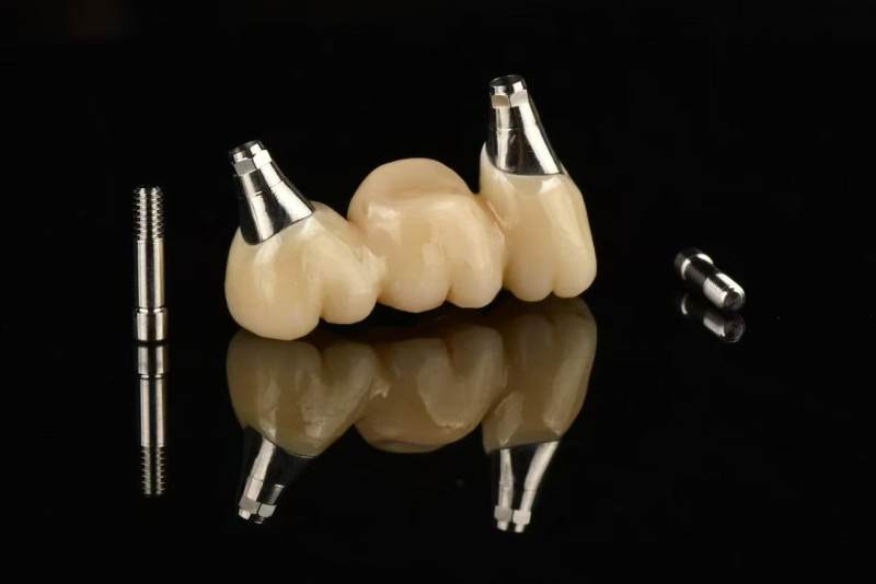 Dental bridge for dental implantation